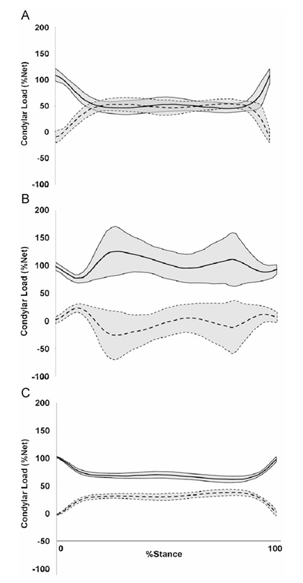 MUSCLE_LOADING.png|300